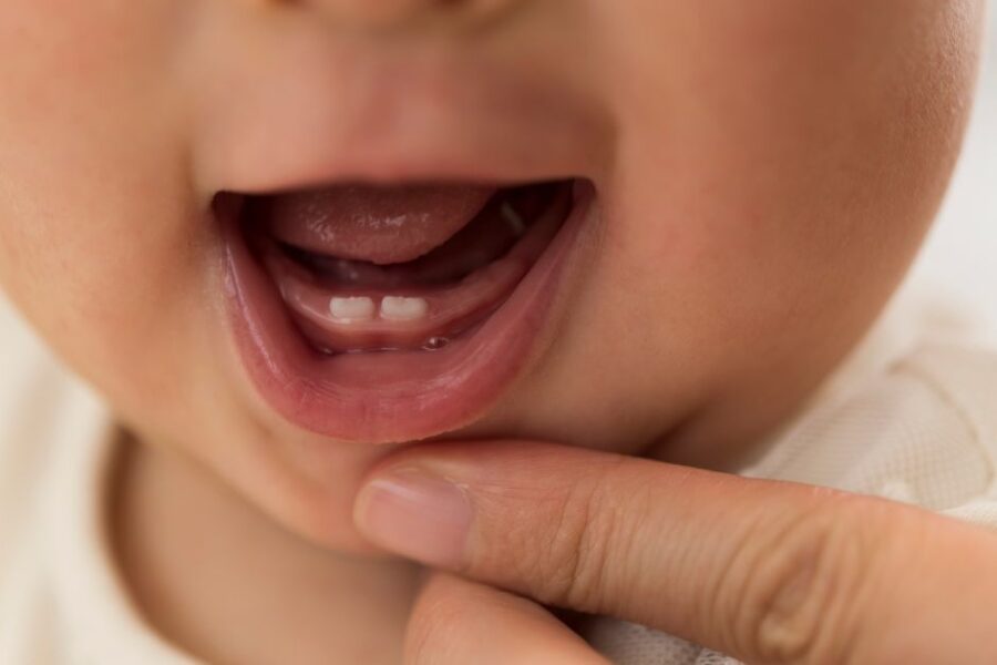 Dientes de bebé