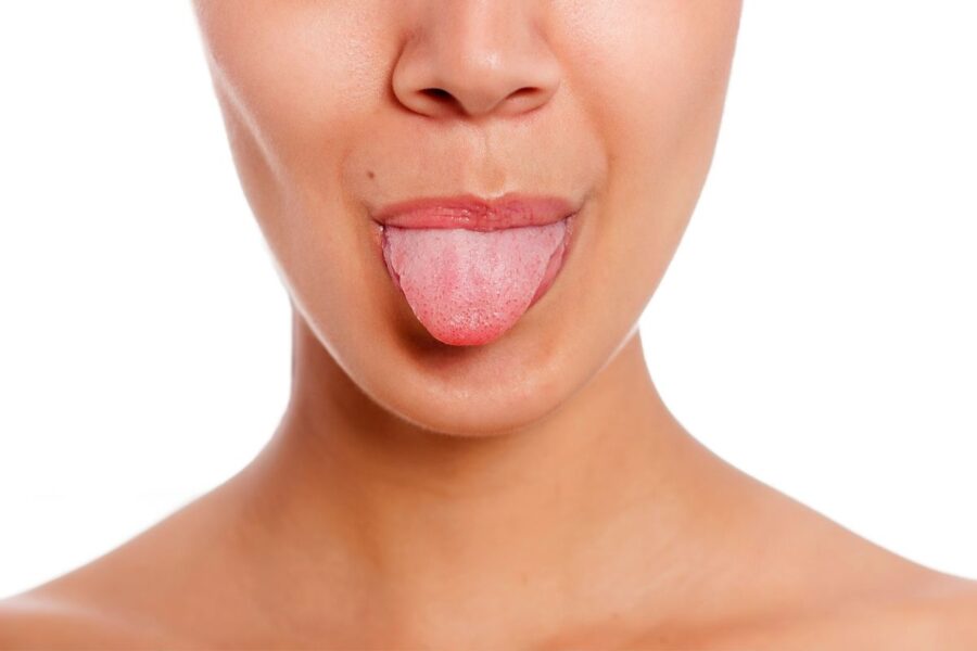 liquen plano oral