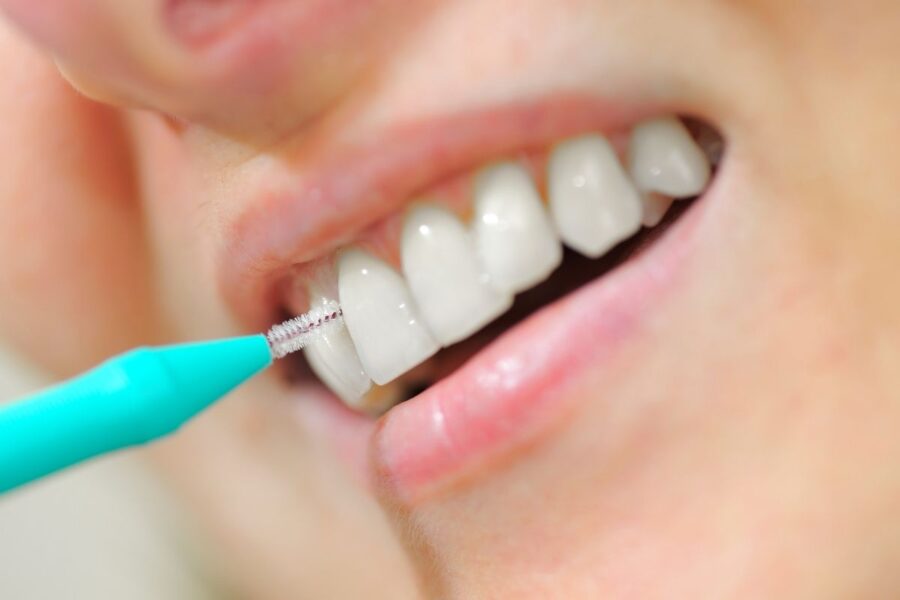Cepillo Interdental - Dra. Irene Borro