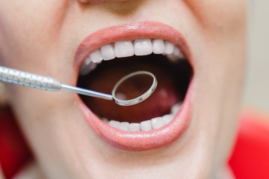 Descubre cómo prevenir el paladar inflamado - Clínica Dental Dra. Borro