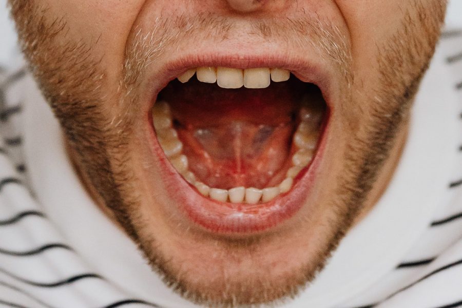 Frenillo corto lingual o anquiloglosia - Clínica Dental Dra. Borro