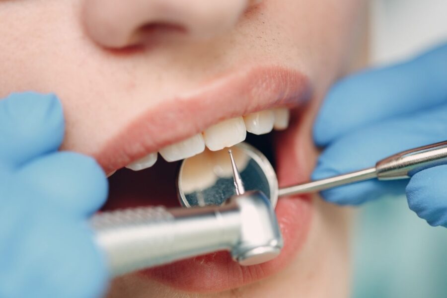 Profilaxis dental