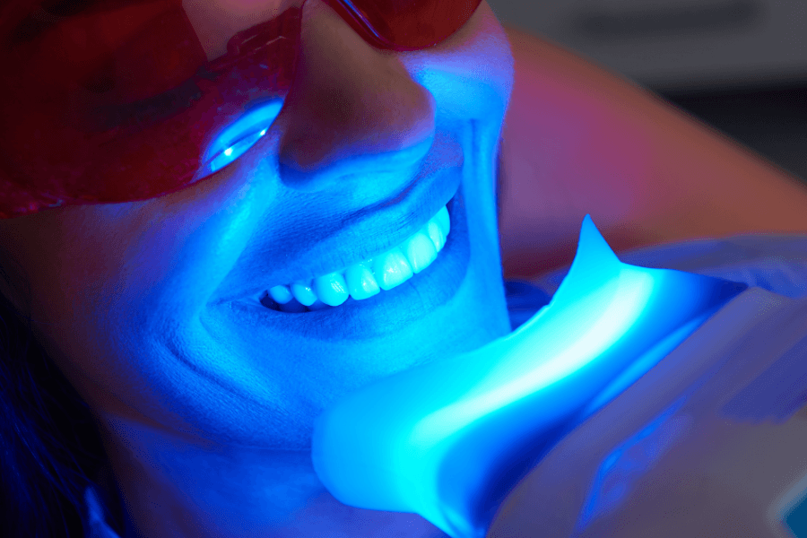Blanqueamiento dental casero: moda peligrosa - Clínica Dental Dra. Borro