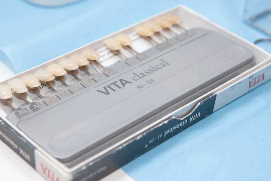 dientes limados para carillas