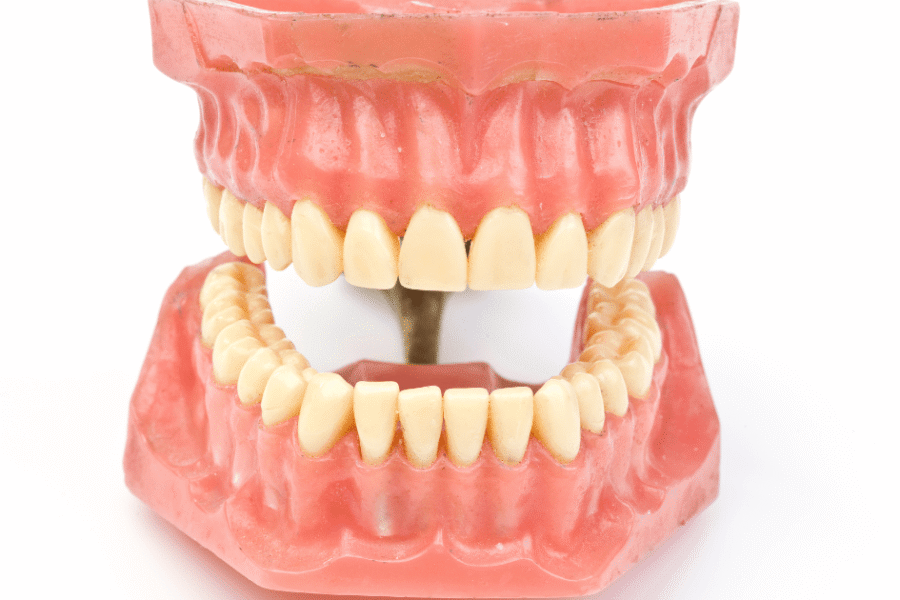 abfracción dental