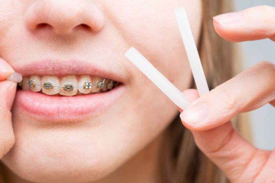 cera dental