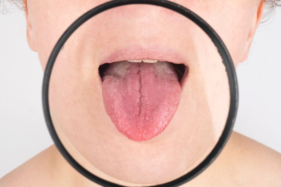 Partes de la lengua