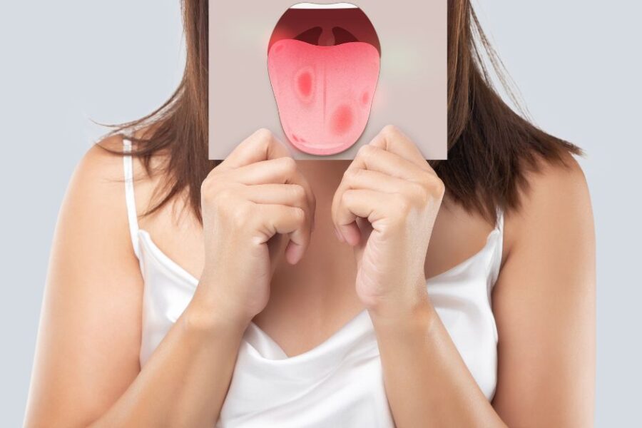 leucoplasia