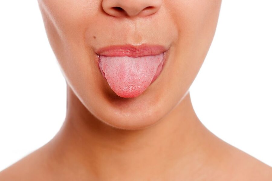 lengua amarilla