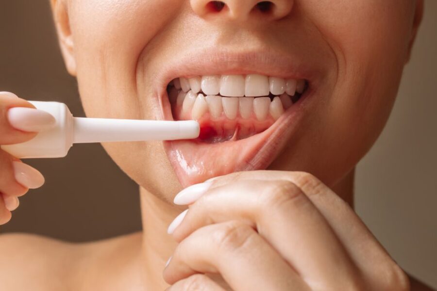 gel para regenerar las encías