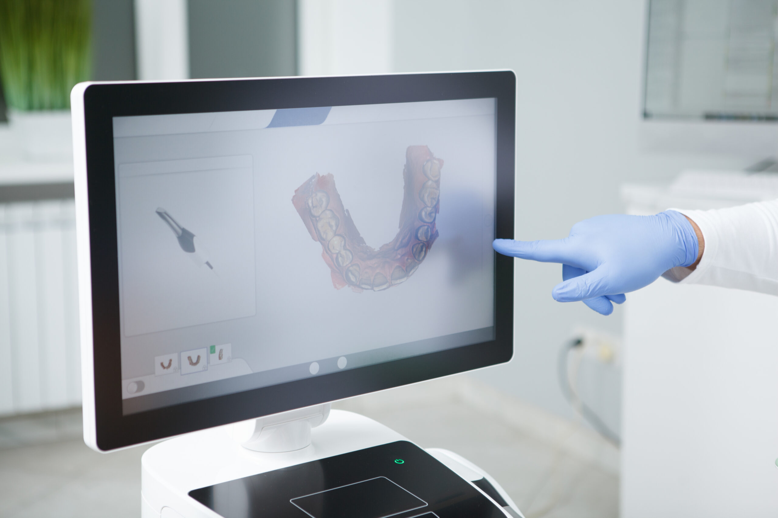 diseño de sonrisa con IA