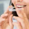 invisalign ataches