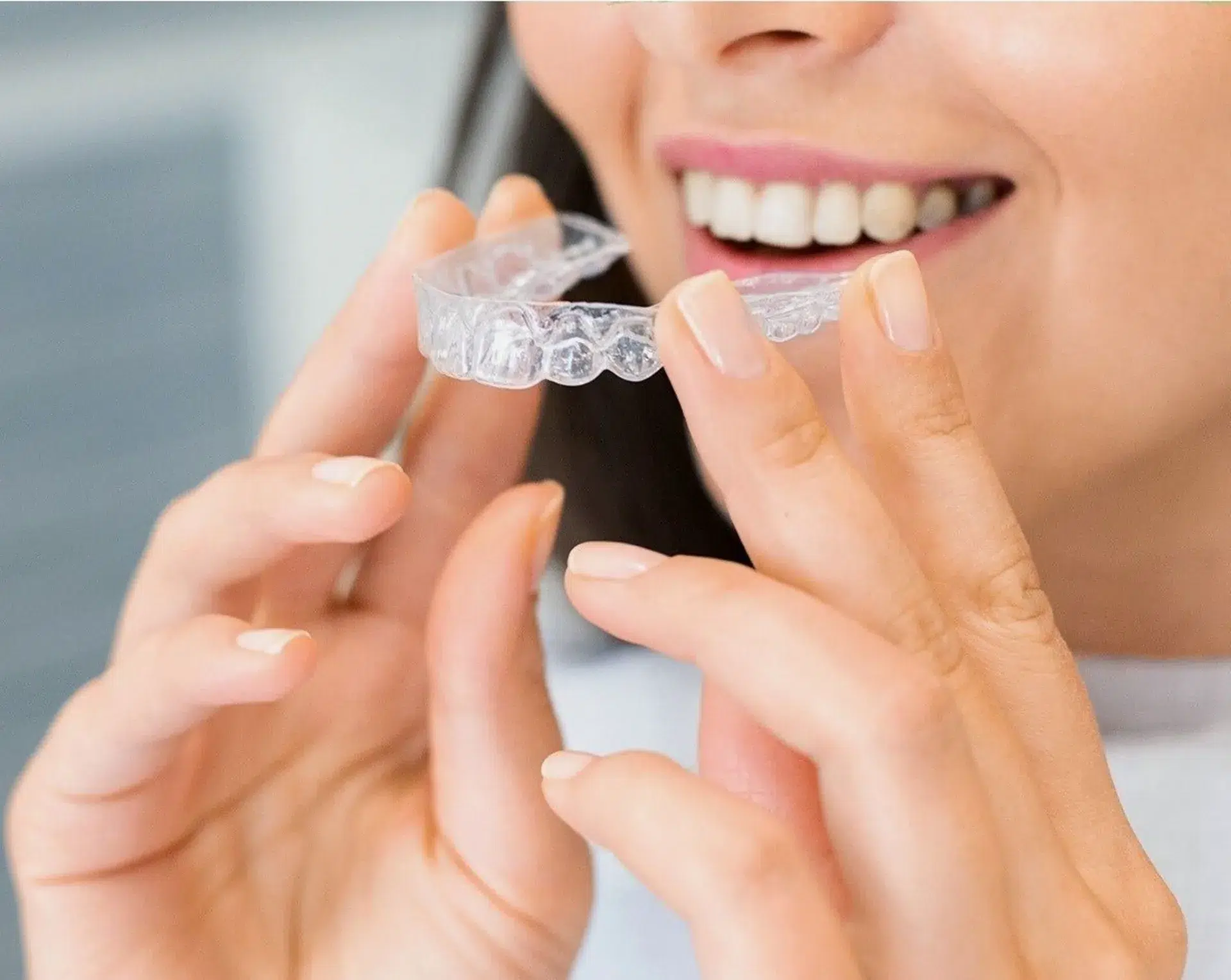 invisalign ataches