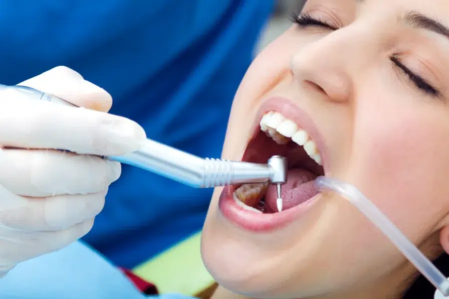 selladores dentales