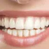 Recesión gingival: qué dice la evidencia sobre cuándo tratar y con qué técnica - Clínica Dental Dra. Borro recesión gingival